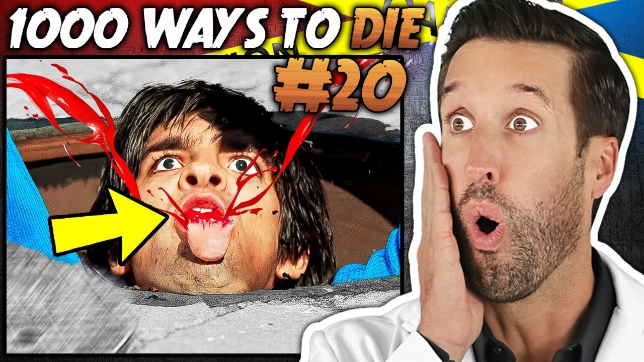 ER Doctor Reacts To 1000 Ways To Die Dumbest Injuries 20 YouTube ER Doctor Reacts To 1000 Ways To Die Dumbest Injuries 20 YouTube